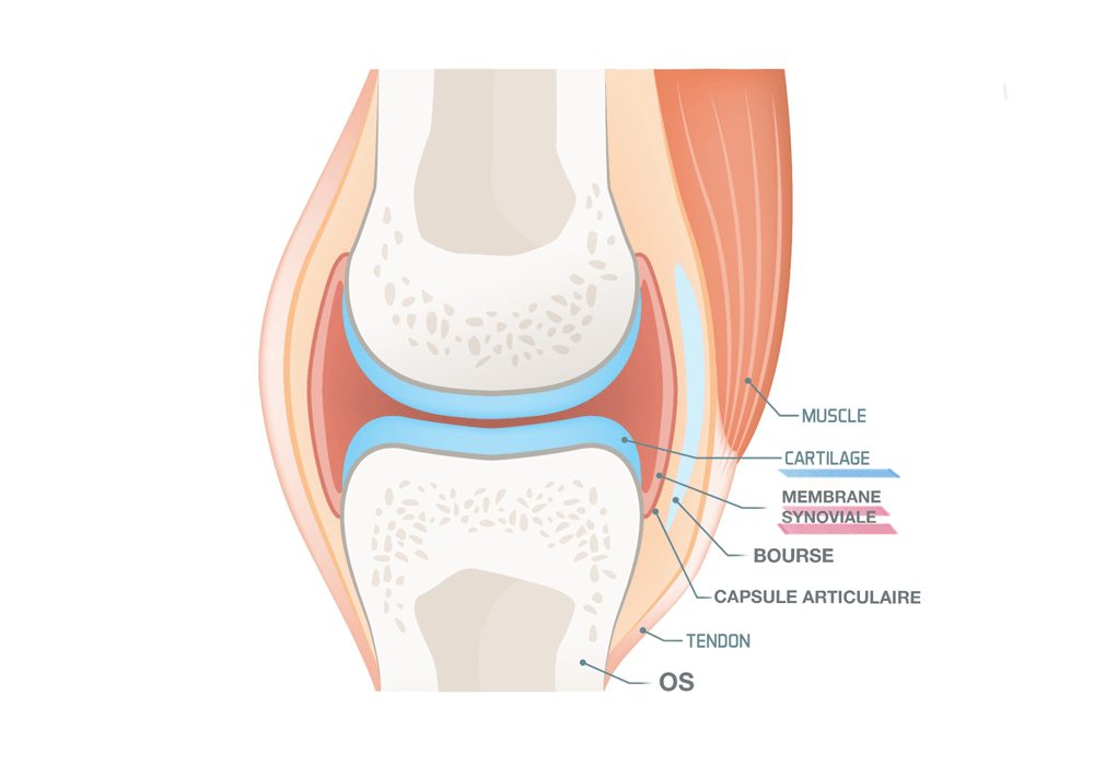 Comprendre la diff rence entre arthrite et arthrose facilement 