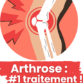 Traitement naturel de l'arthrose